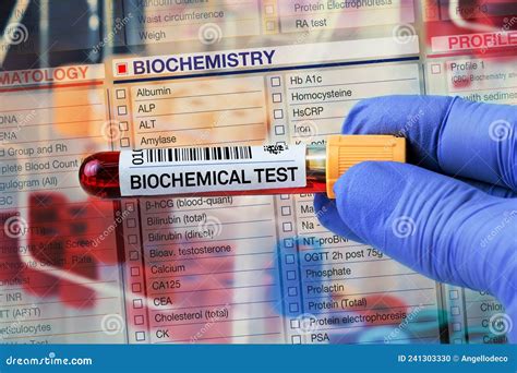 laboratory biochemistry analysis|biochemistry tests in laboratory.